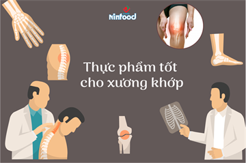 CÁC THỰC PHẨM TỐT CHO BỆNH XƯƠNG KHỚP